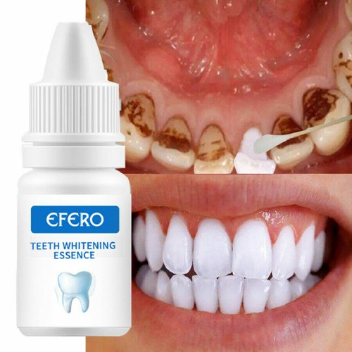 Teeth whitening essence - teeth,