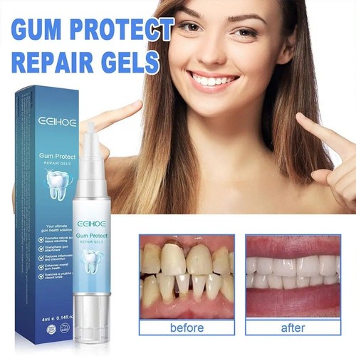 Teeth whitening gel pen extra - teeth,